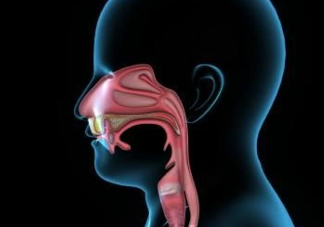 Image of dysphagia 